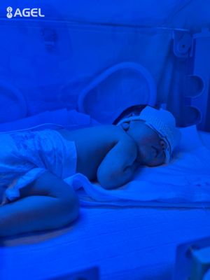Čas liečby novorodeneckej žltačky v krompašskej nemocnici klesol o 50%